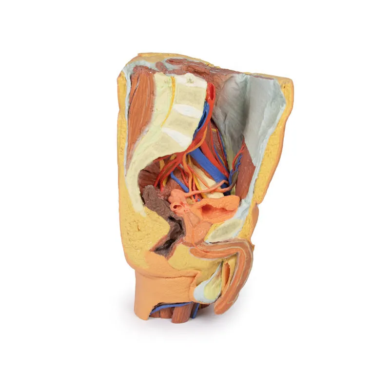 3D Printed Male left pelvis and proximal thigh