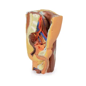 3D Printed Male left pelvis and proximal thigh