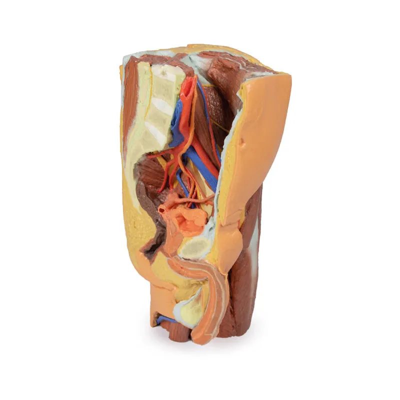 3D Printed Male left pelvis and proximal thigh