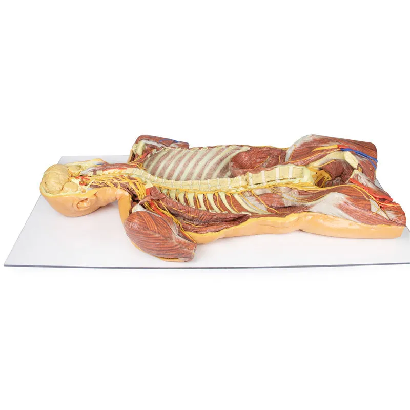 3D Printed Posterior Body Wall - Ventral Deep Dissection