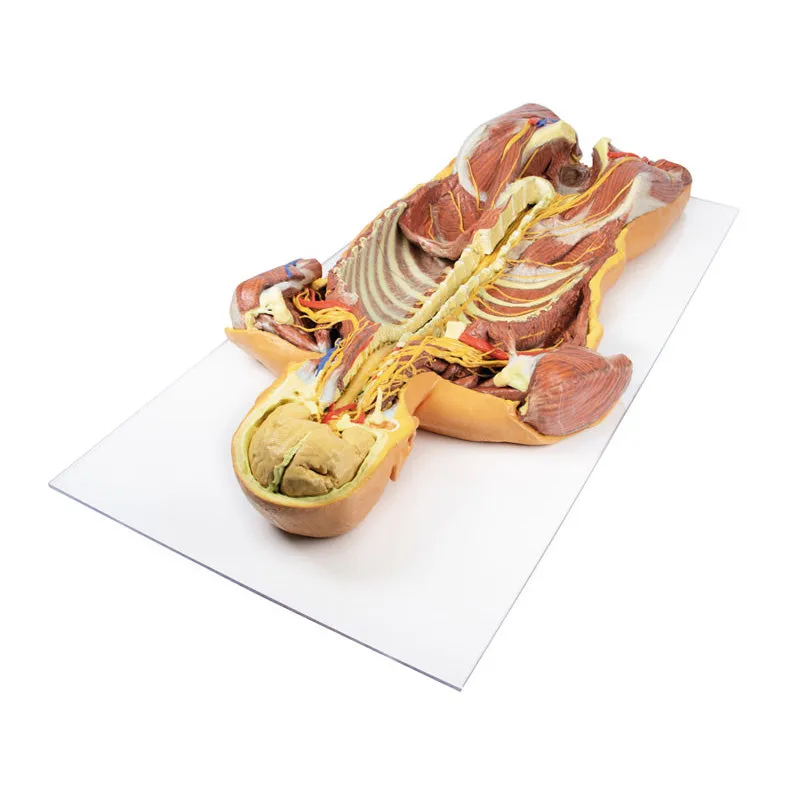 3D Printed Posterior Body Wall - Ventral Deep Dissection