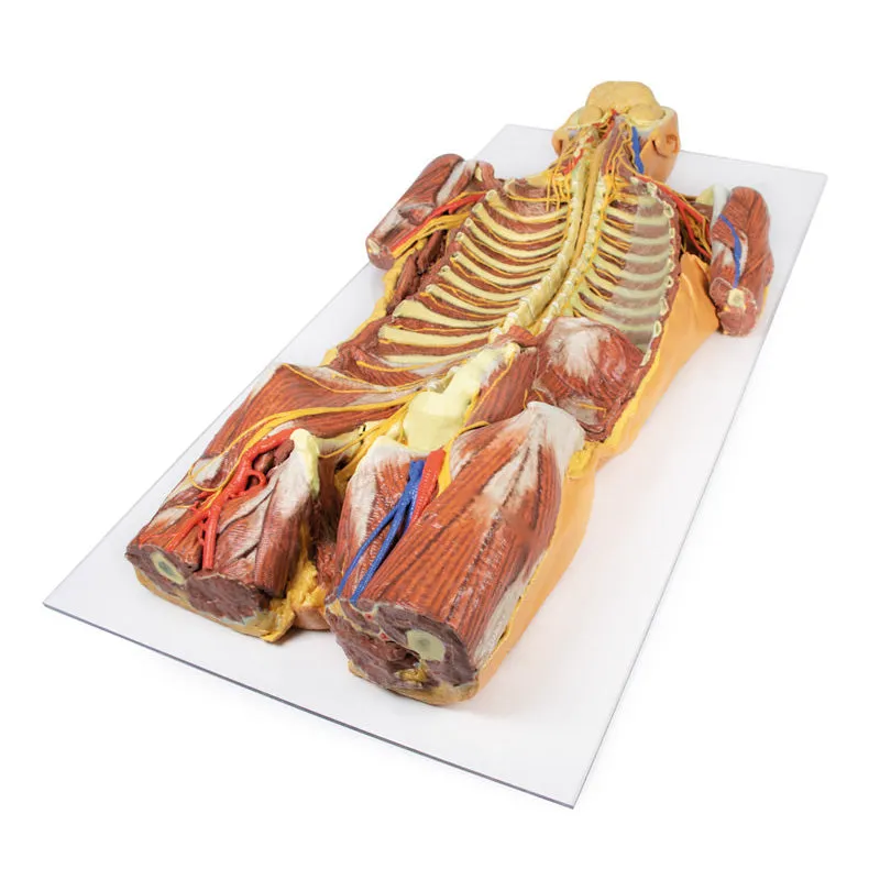 3D Printed Posterior Body Wall - Ventral Deep Dissection