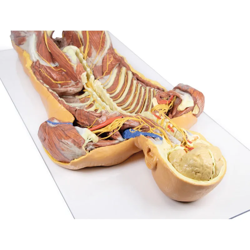 3D Printed Posterior Body Wall - Ventral Deep Dissection