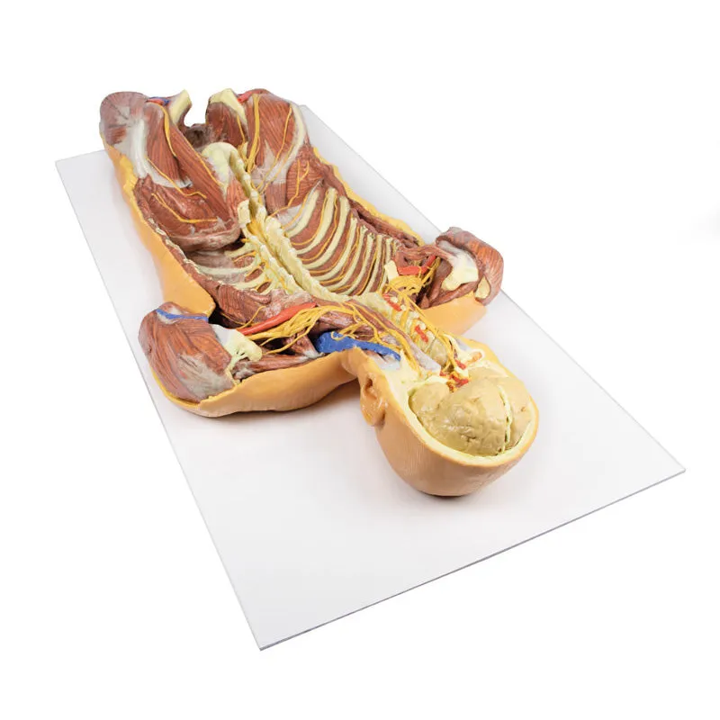 3D Printed Posterior Body Wall - Ventral Deep Dissection