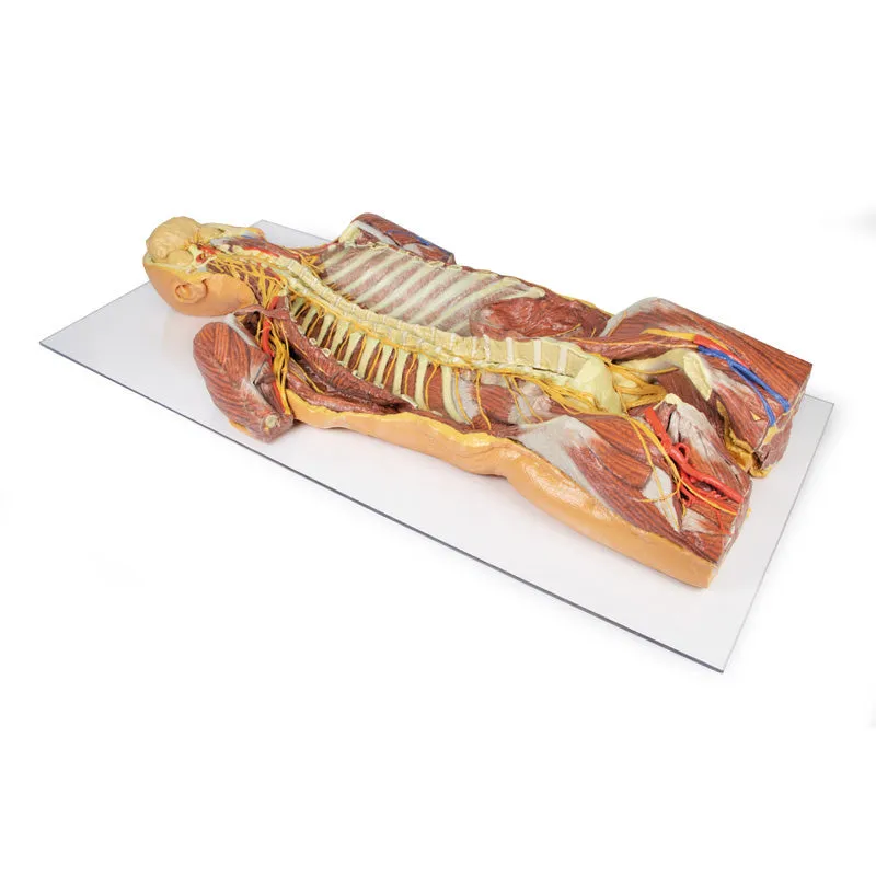 3D Printed Posterior Body Wall - Ventral Deep Dissection