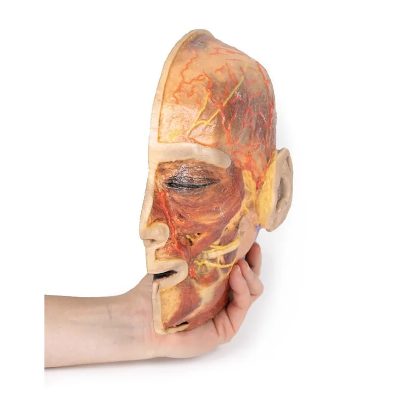 3D Printed Superficial Facial Nerves & Parotid Gland