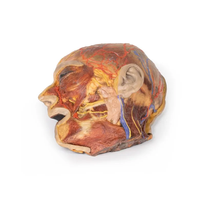 3D Printed Superficial Facial Nerves & Parotid Gland
