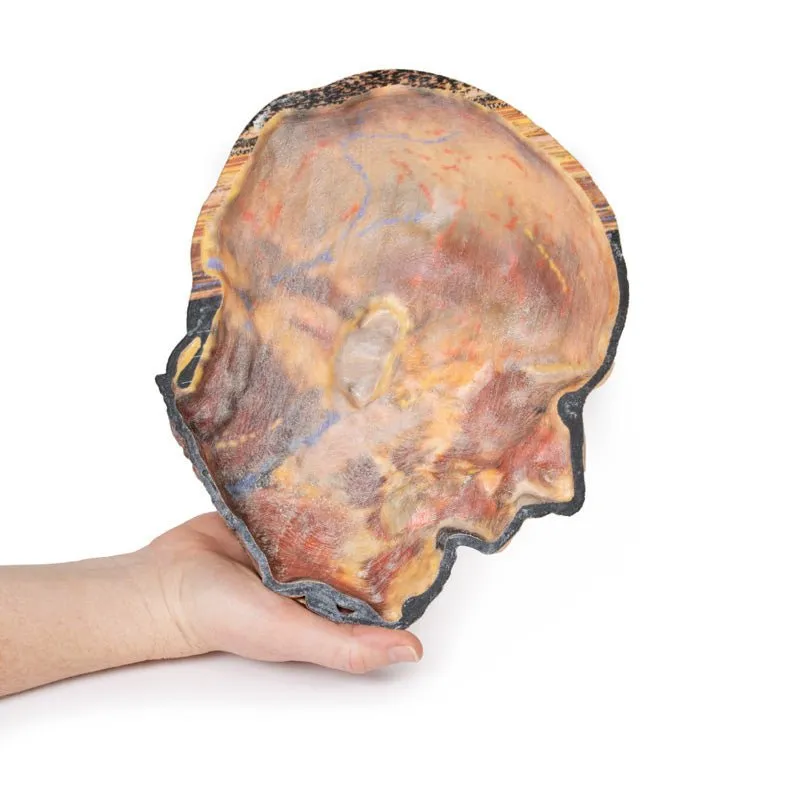 3D Printed Superficial Facial Nerves & Parotid Gland