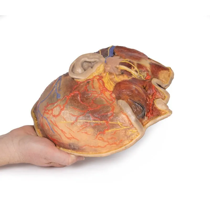 3D Printed Superficial Facial Nerves & Parotid Gland